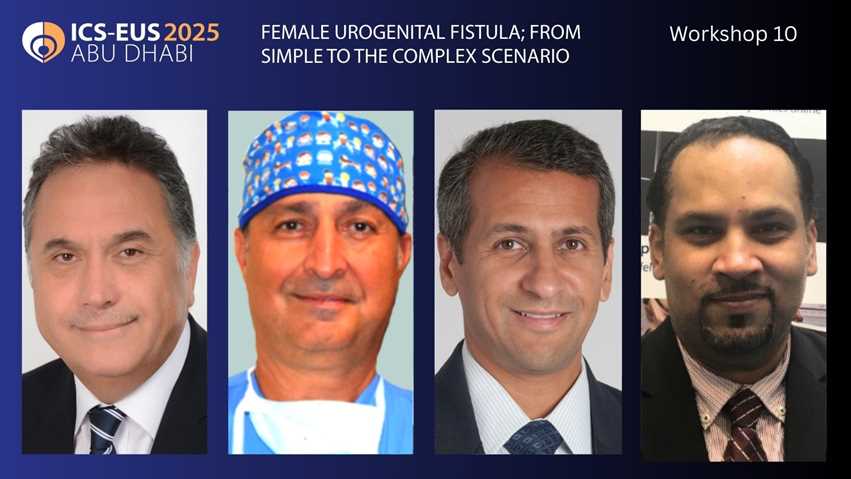 Female Urogenital Fistula; From Simple to the Complex Scenario